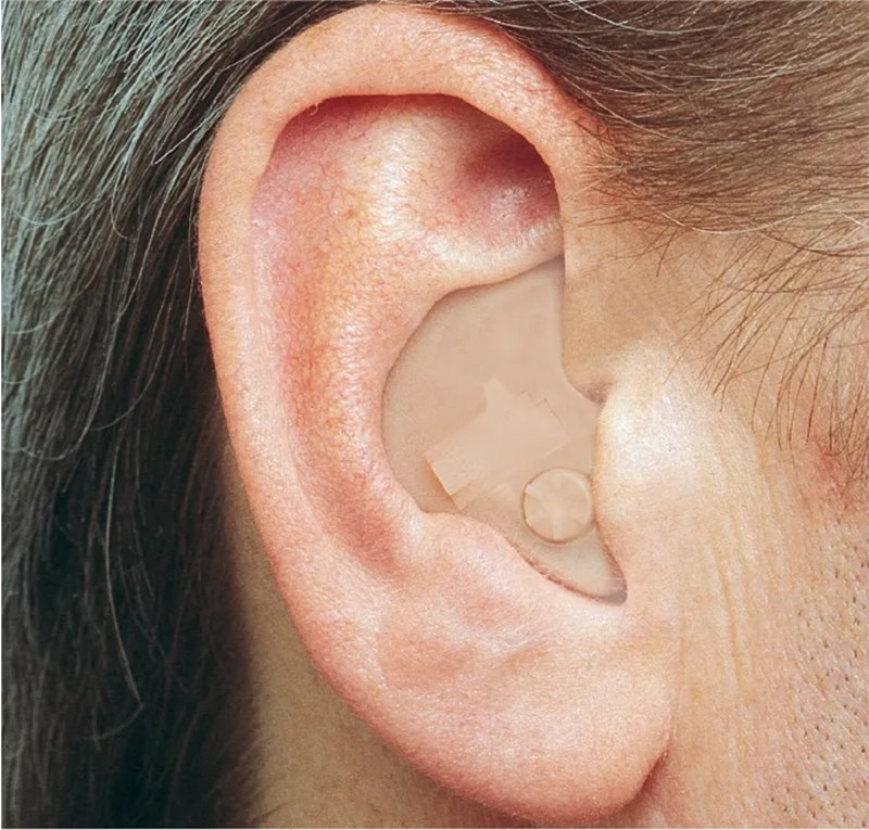 Hearing Aids