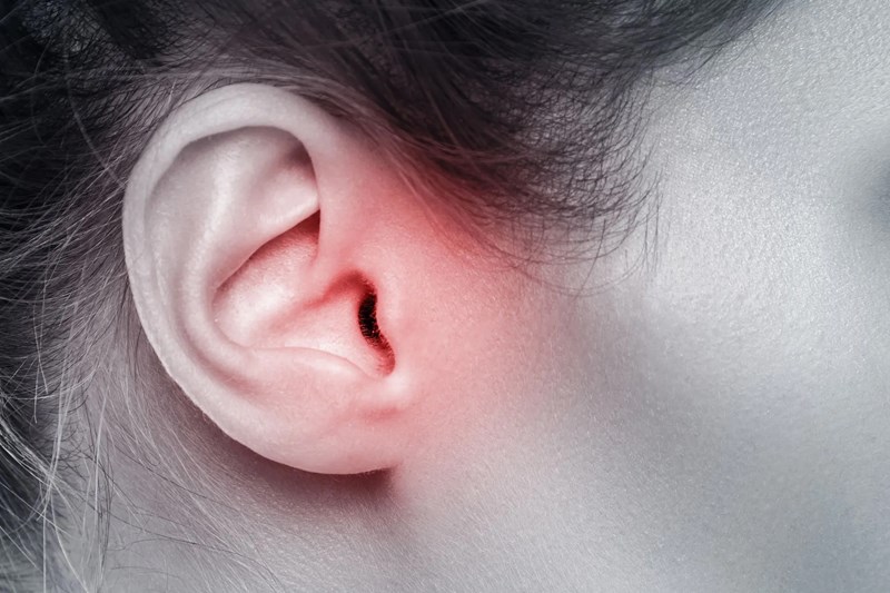 Tinnitus Management | Tinnitus Test